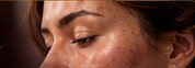 Rostro de mujer con piel acneica en perfil